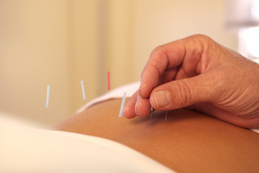 Prenatal Acupuncture