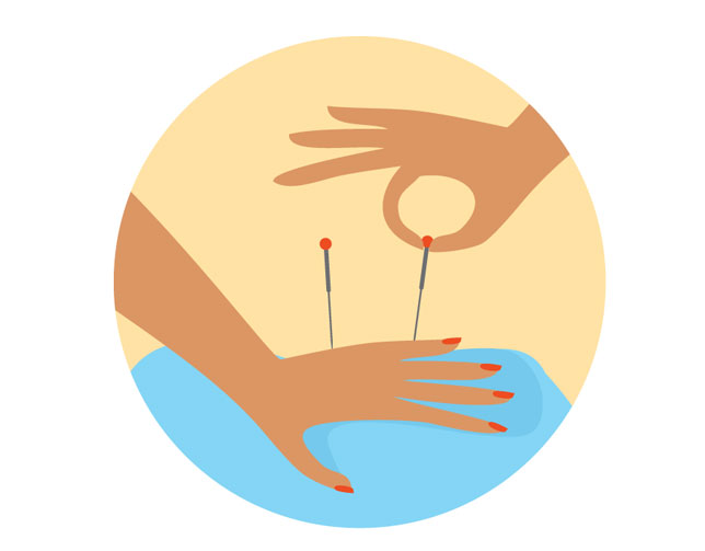 Acupuncture hand illustration