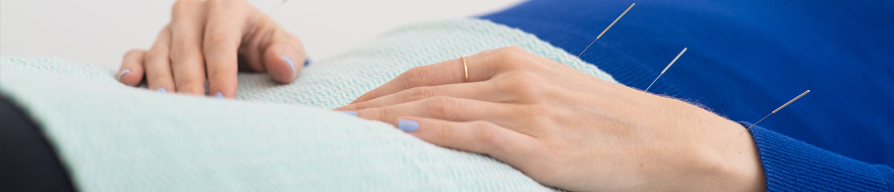 Hands with acupuncture needles