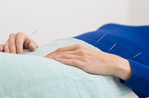 Hands with acupuncture needles