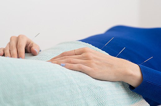Hands with acupuncture needles